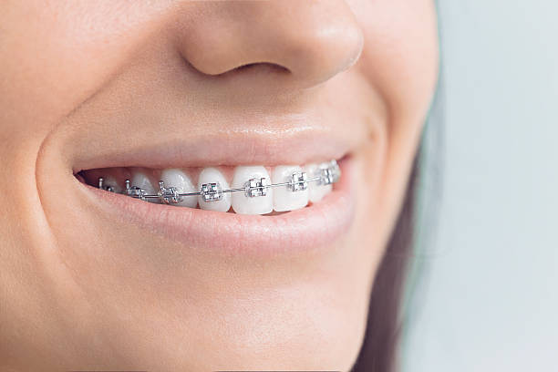 Laser Dentistry in Franklin, CA
